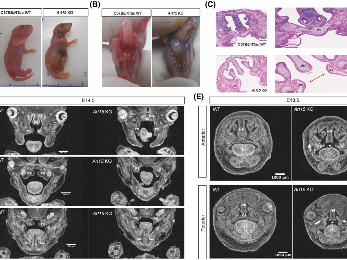 Cleft palate and minor metabolic disturbances in a mouse global Arl15 gene knockout