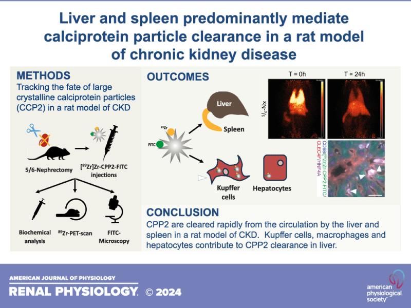 Liver and spleen predominantly mediate calciprotein particle clearance in a rat model of chronic kidney disease