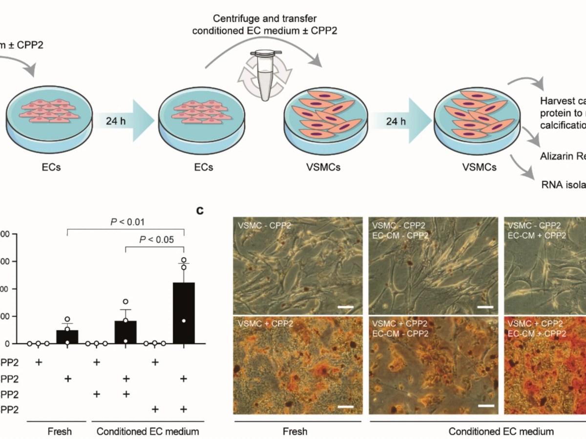 Calciprotein particle-activated endothelial cells aggravate smooth muscle cell calcification via paracrine signalling