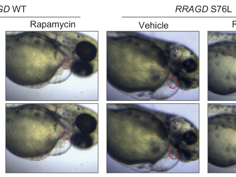 RRAGD variants cause cardiac dysfunction in a zebrafish model
